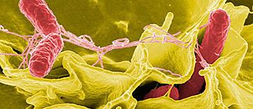 Bacteria Legionella - Sanitersur